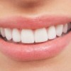Una mala salud bucal puede ocasionar la muerte Dientes blancos