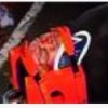 Cantante boricua Manny Manuel sufre un accidente muy raro Manny Manuel