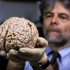 Fumar daña el cerebro cerebro-humano