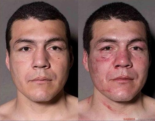 Boxeadores antes y después de las peleas, mire bien las fotos